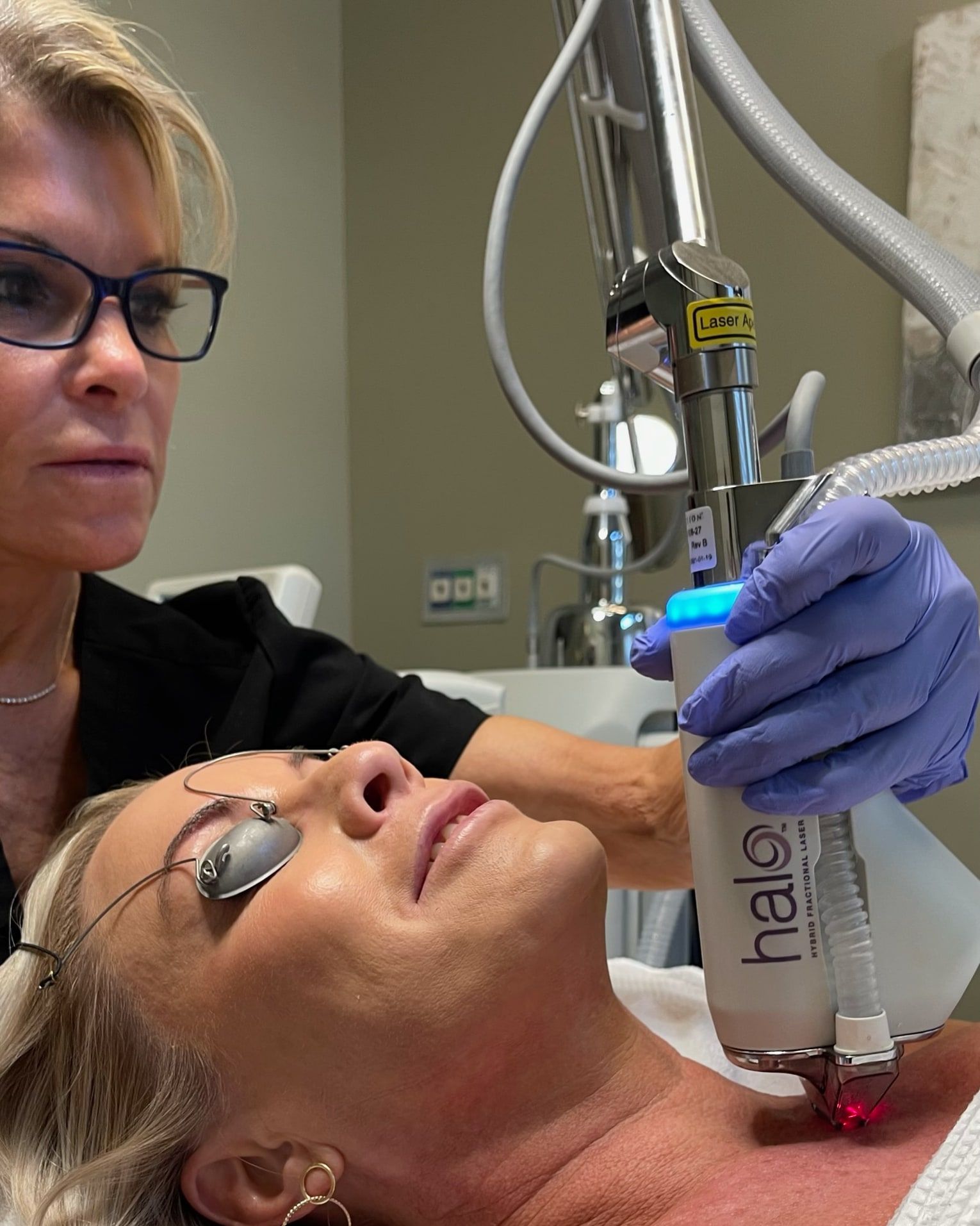 Halo Laser Resurfacing at Wellspring Skincare in Roswell