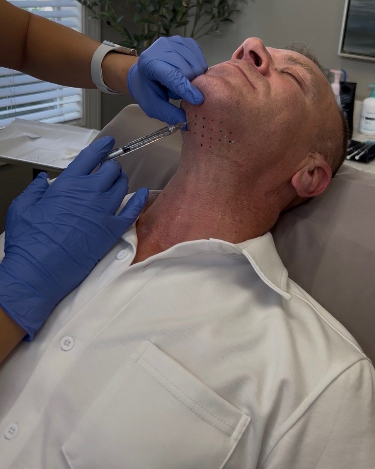 Kybella under-chin treatment at Wellspring Skincare in Roswell