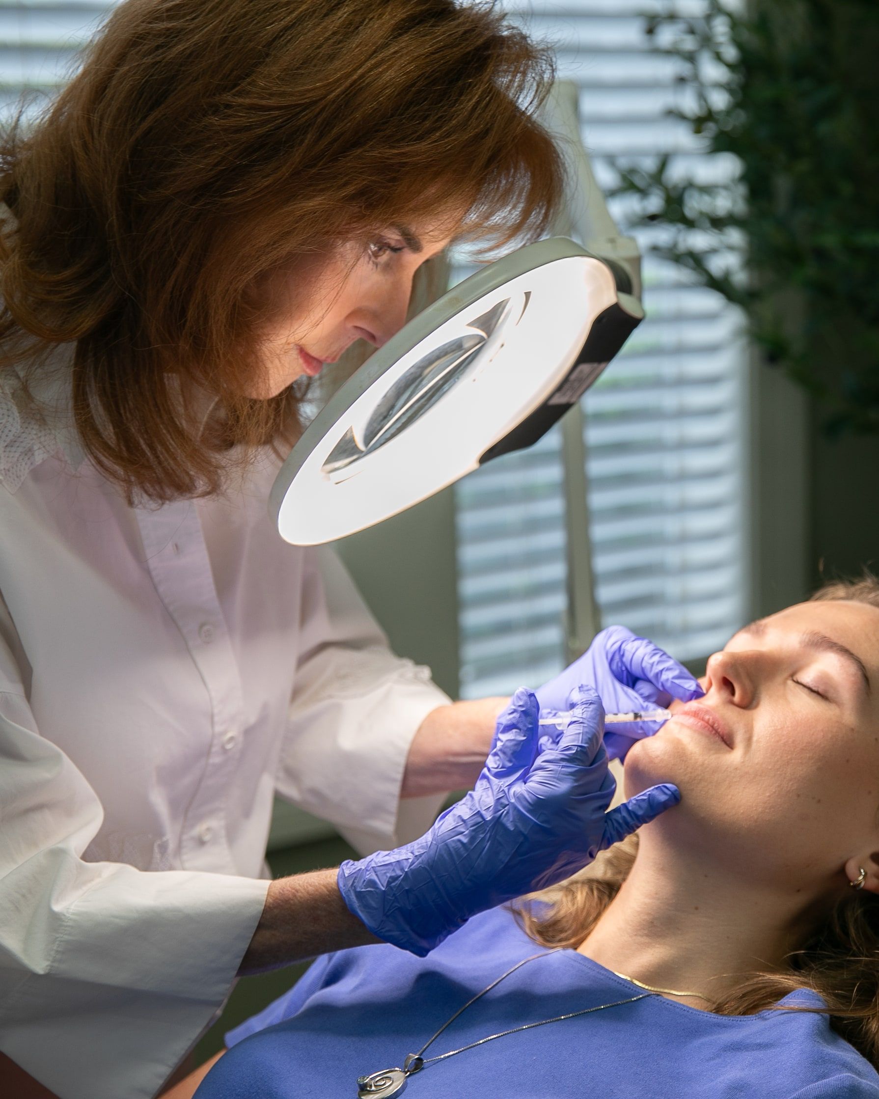 Lip Filler at Wellspring Skincare in Roswell