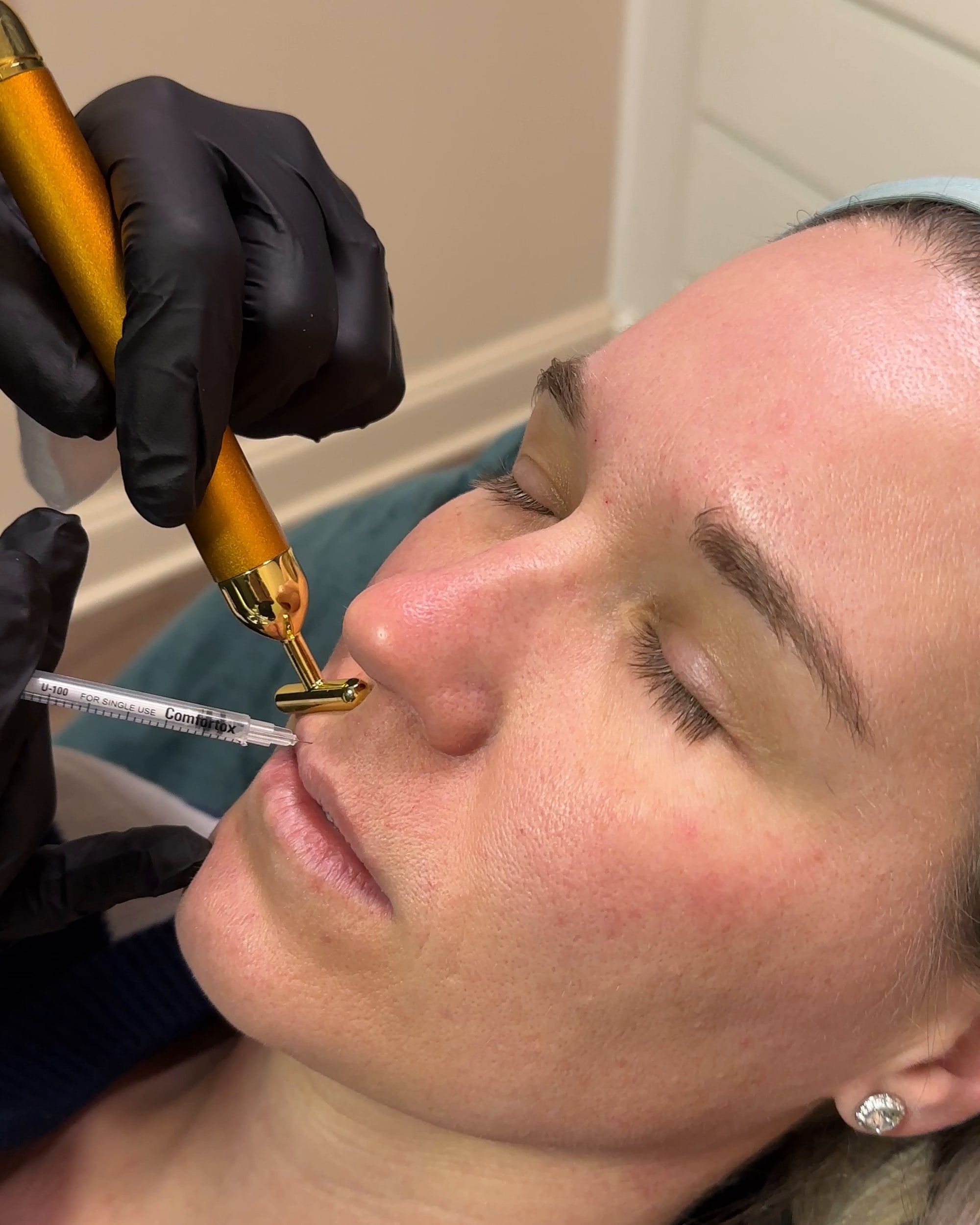 Lip Flip at Wellspring Skincare in Roswell
