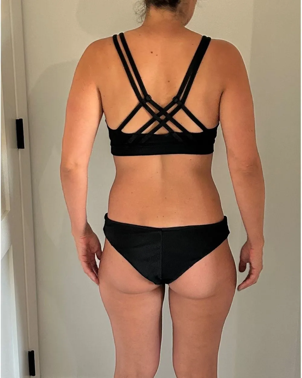 After: After Medical weight loss