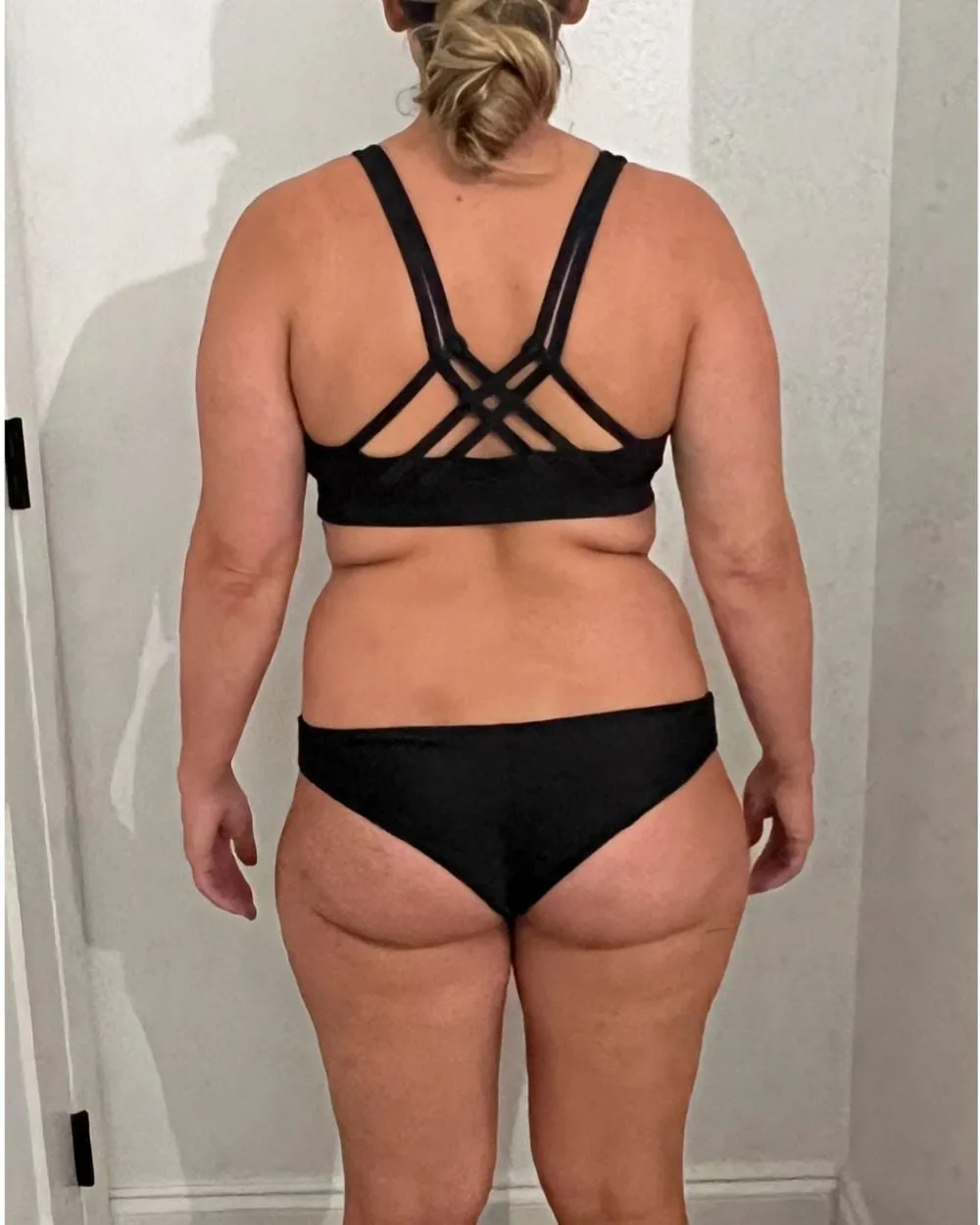 Before: After Medical weight loss
