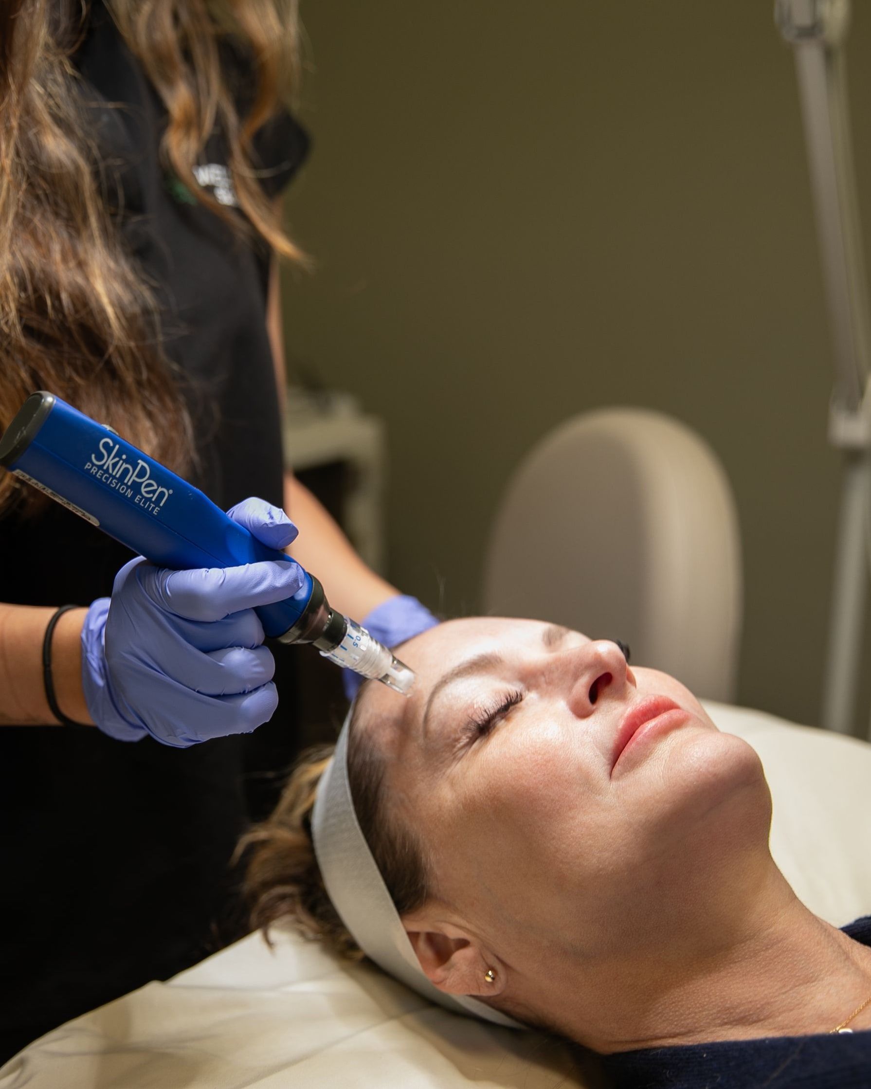 Microneedling treatment at Wellspring Skincare in Roswell