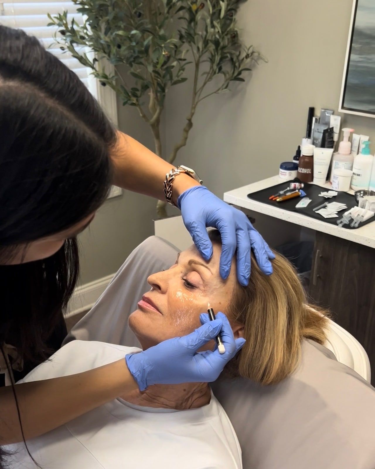 PDO Thread Lift at Wellspring Skincare in Roswell